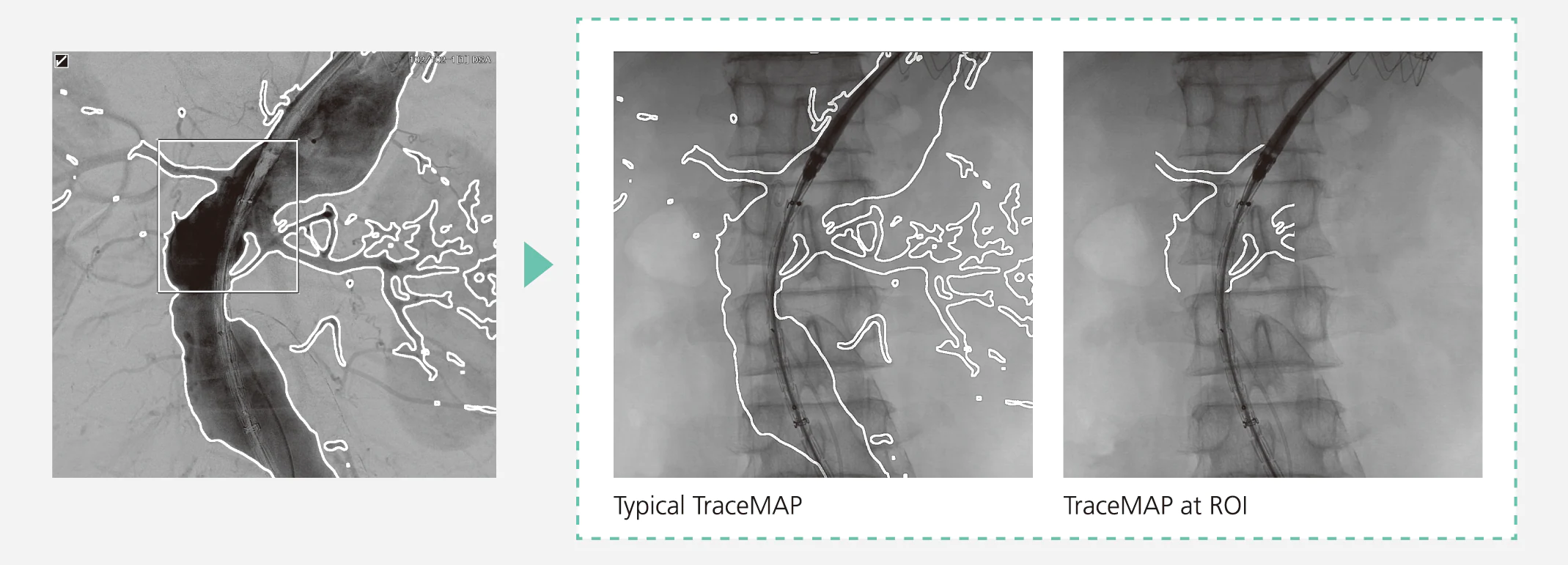 TraceMAP(SCORE MAP)